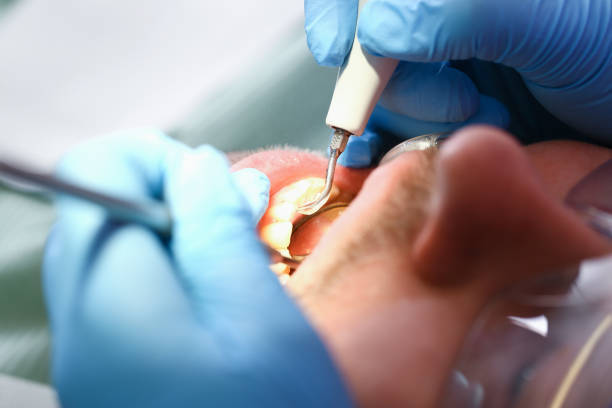 Best Dental Abscess Treatment in Centerville, PA