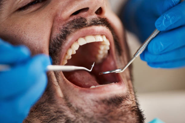 Best Broken or Chipped Tooth Repair in Centerville, PA